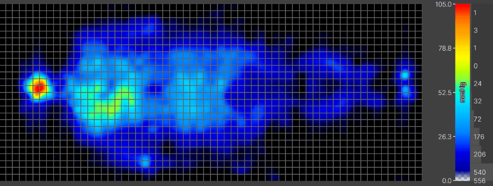 Grid image with the outlines of a person’s body lying on their back on a pressure mat