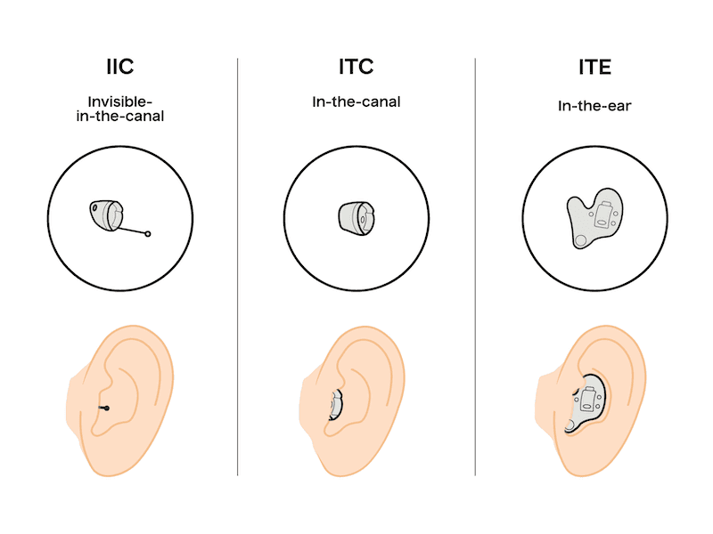 A graphic image showing the shape of invisible-in-canal (IIC), in-the-canal (ITC), and in-the-ear (ITE) hearing aids