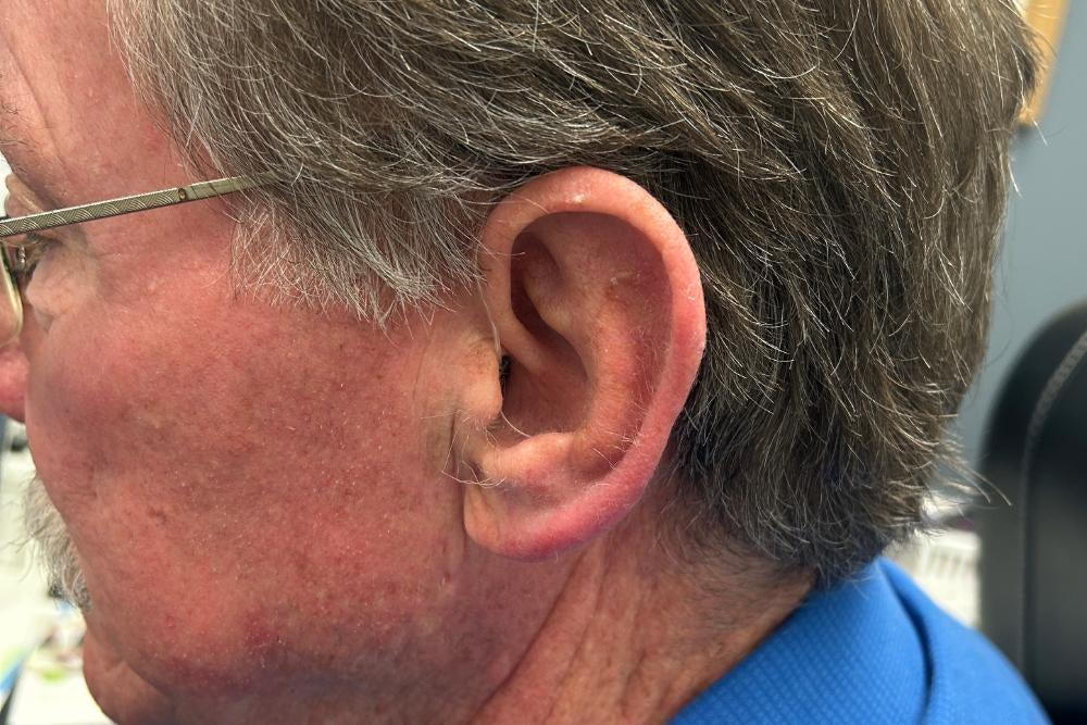 Starkey hearing aid in man's left ear