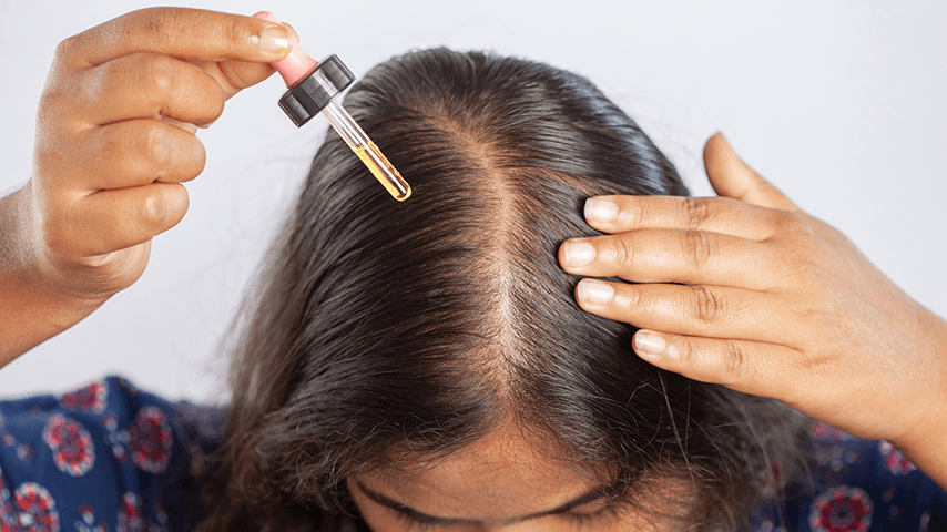 overhead view of woman applying hair loss serum to her head