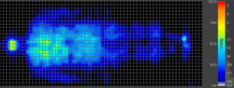 Pressure map reading of person lying on their back on the Saatva Rx